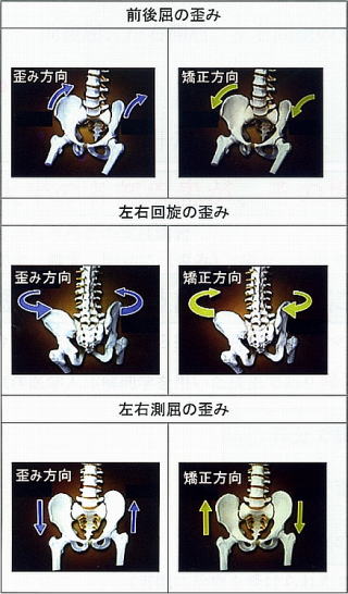 骨盤の歪みか方の種類 骨盤の前後屈の歪み 骨盤の左右バランスの歪み 左右側屈の歪み