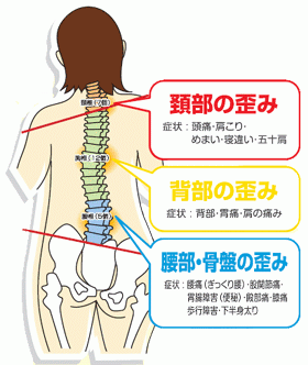 骨盤がゆがむと首方の痛み背中の痛み肩こり腰痛になります