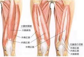 大腿四頭筋