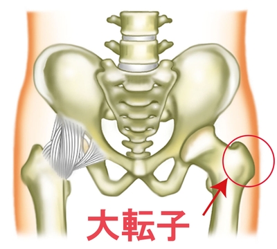 大転子は太ももの大腿骨の骨の一部