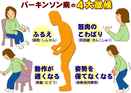 パーキンソン病-4