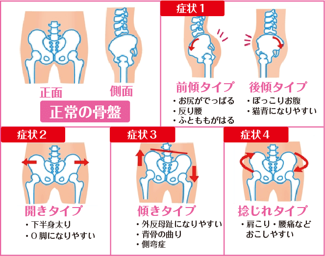 スカートが回ってしまう原因は骨盤の歪みから その対策は骨盤矯正が有効 志木駅 志木イーバランス整体院