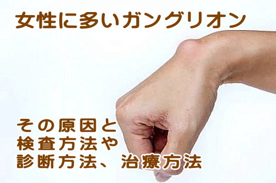 ガングリオン その症状の原因、検査方法や治療法