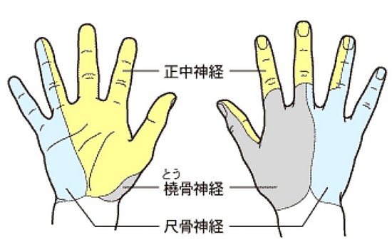 手根管症候群の症状臨床所見
