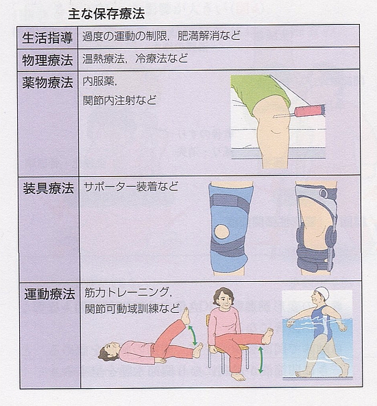 変形性膝関節症の保存療法