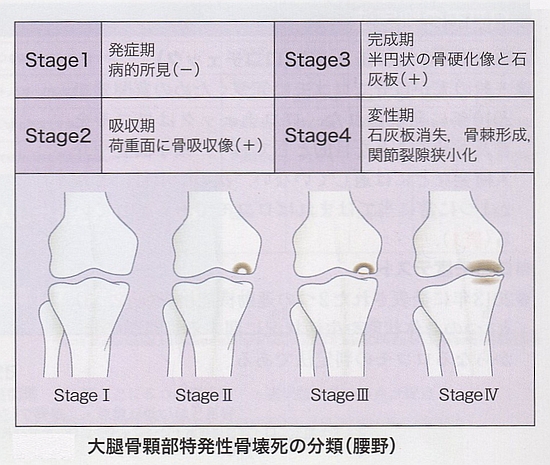 特発性大腿骨顆部壊死の分類