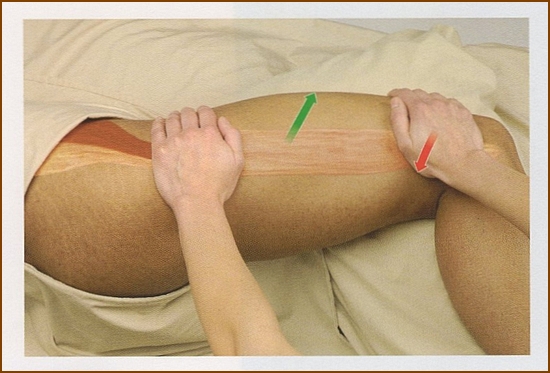 腸脛靭帯の触診方法