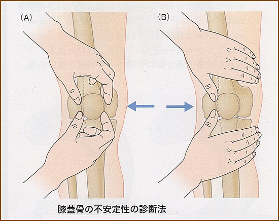 膝蓋大腿関節障害の検査方法