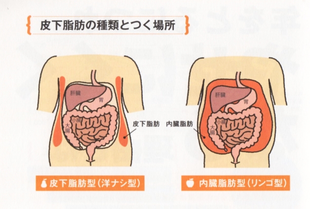 脂肪の種類は2種類・皮下脂肪と内臓脂肪