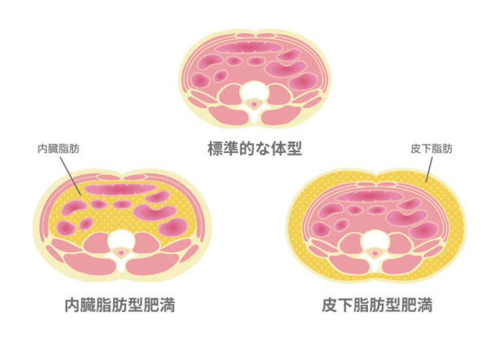 内臓脂肪と皮下脂肪