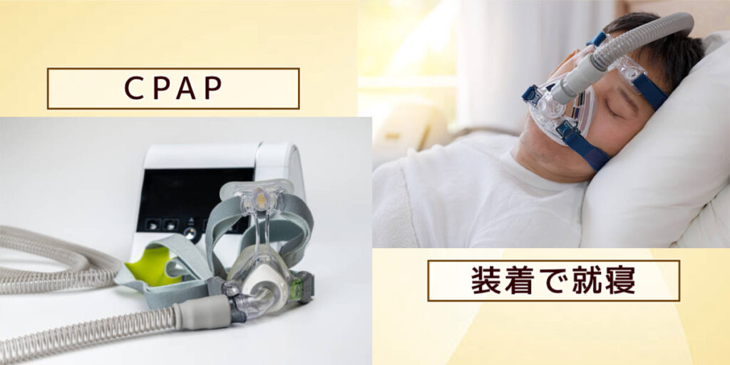 CPAP