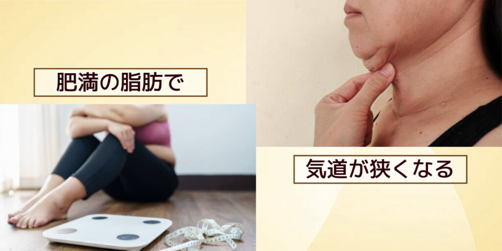 脂肪で気道が狭くなる