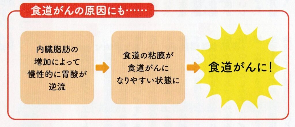 食道がんに