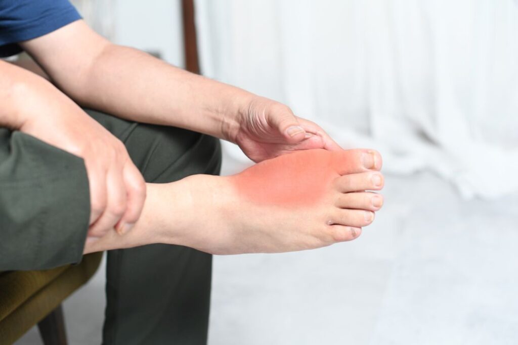 痛風は足の親指の根元に痛み