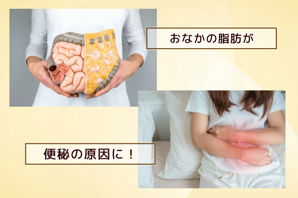 お腹の脂肪が便秘の原因に