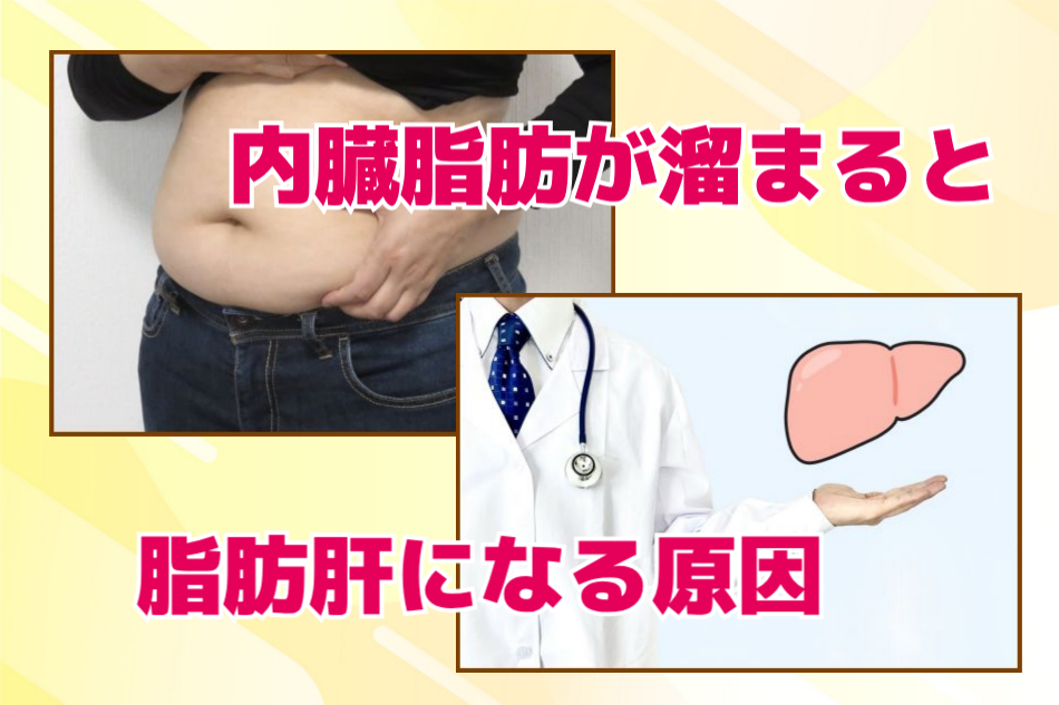 内臓脂肪で脂肪肝になる原因