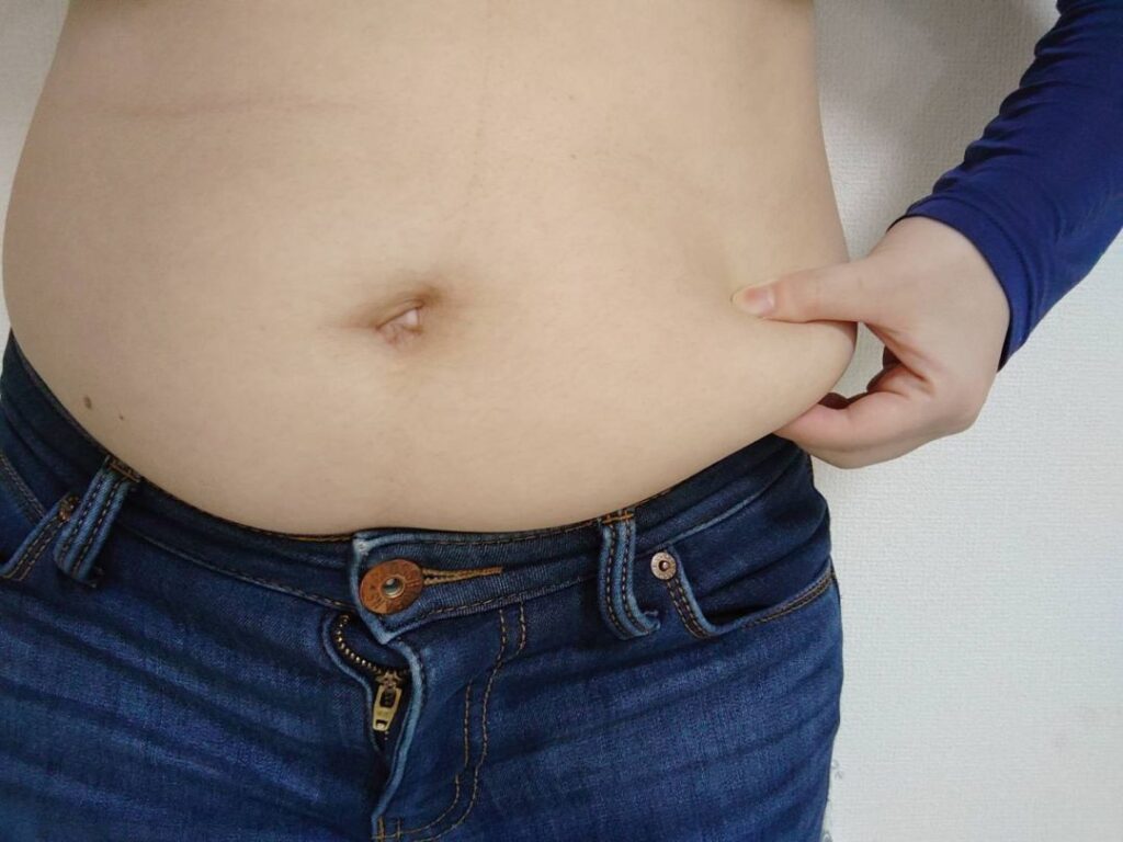 女性のお腹の脂肪