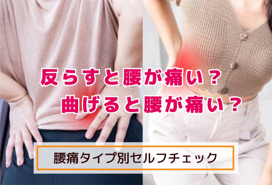 反らすと痛い？曲げると痛い？腰痛タイプ別セルフチェック