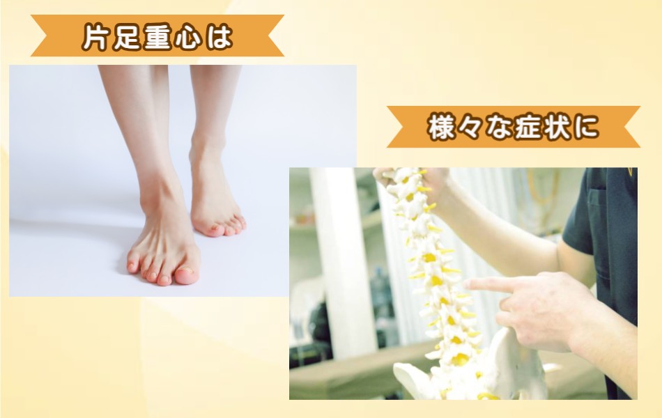 片足重心で骨盤の歪み