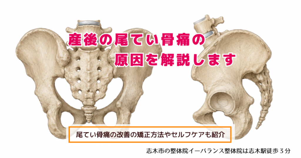 産後の尾てい骨痛の原因を解説します 尾てい骨痛の改善の矯正法違法やセルフケアも紹介