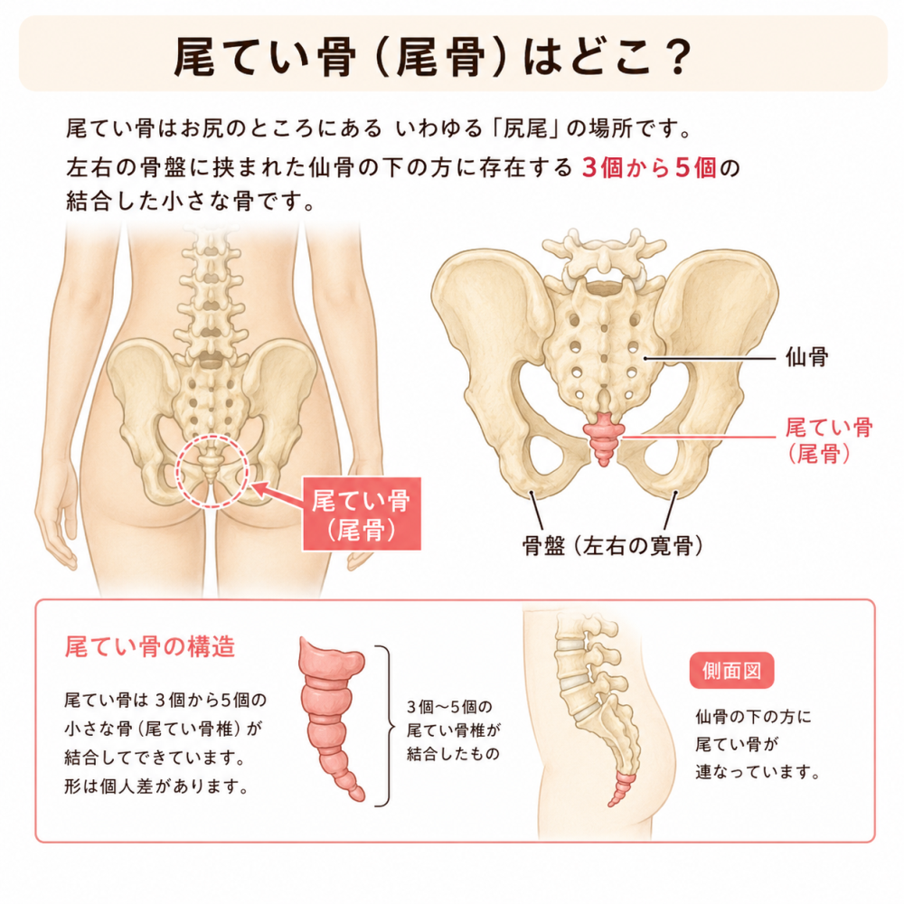 ★尾てい骨（尾骨）はどこ？尾てい骨はお尻のところにある、いわゆる「尻尾」の場所です。左右の骨盤に挟まれた仙骨の下の方に存在する3個から5個の結合した小さな骨です。●尾てい骨の構造尾てい骨は3個から5個の小さな骨（尾てい骨椎）が結合してできています。形は個人差があります。●側面図仙骨の下の方に尾てい骨が連なっています。