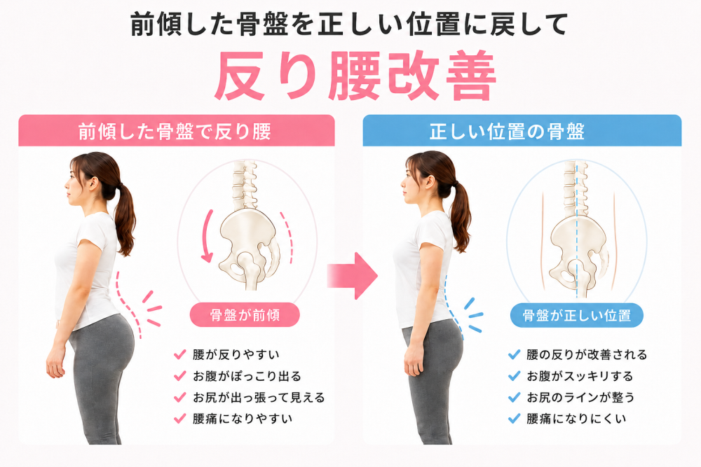 ★変形した骨盤を正しい位置に戻して反り腰改善■前傾した骨盤で反り腰●骨盤が前傾・腰が反りやすい・お腹がぽっこり出る・お尻が出っ張って見える・腰痛になりやすい■正しい位置の骨盤●骨盤が正しい・腰の反りが改善される・お腹がすっきりする・お尻のラインが整う・腰痛になりにくい