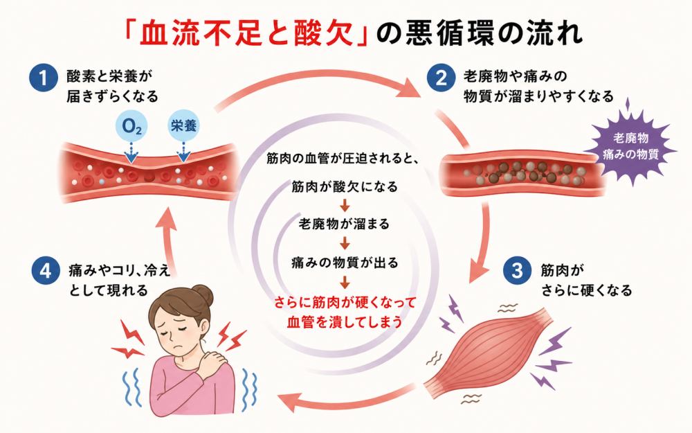 「血流不足と酸欠」の悪循環の流れ①酸素と栄養が届きずらくなる②老廃物や痛みの物質が溜まりやすくなる③筋肉がさらに硬くなる④痛みやコリ、冷えとして現れる以上のように、筋肉の血管が圧迫されると、 ・筋肉が酸欠になる ➔ ・老廃物が溜まる ➔ ・痛みの物質が出る ➔ ・さらに筋肉が硬くなって血管を潰してしまう というコリや痛みのスパイラル