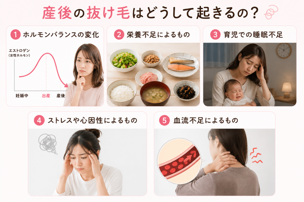 産後の抜け毛がそうして起きるの？①ホルモンバランスの変化②栄養不足によるもの③育児での睡眠不足 ④ストレスや心因性によるもの⑤血流不足によるもの